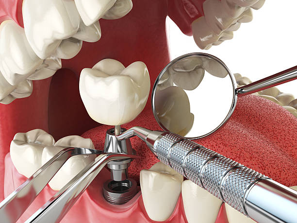 Best Mobile Emergency Dentist in Porterville, CA